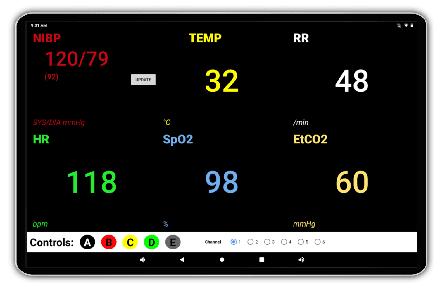 Vital Signs Monitor