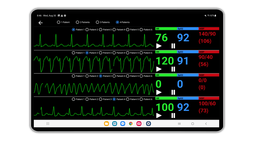Advanced Cardiac Rhythm Recognition Training