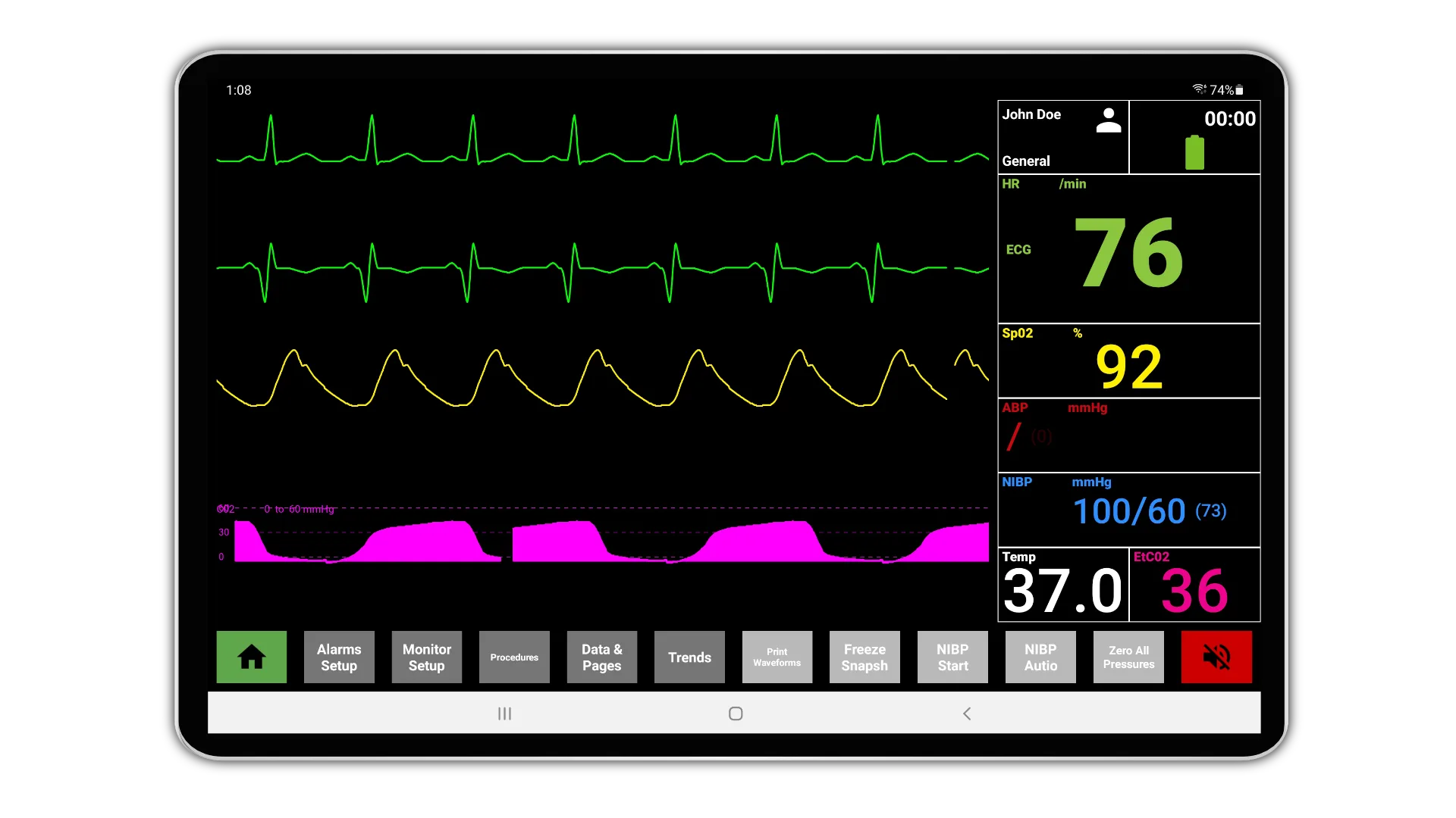 Hospital Monitor