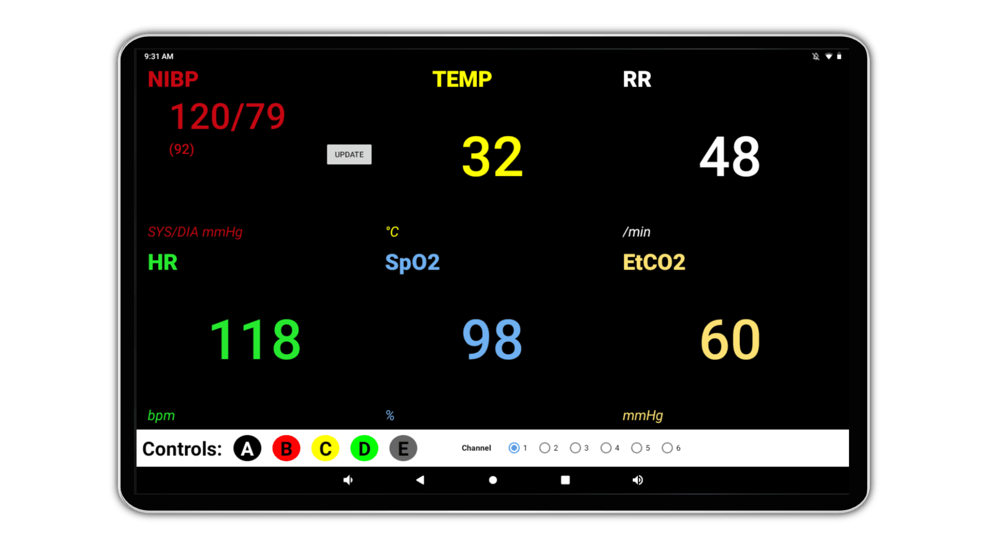 Vital Signs Monitor