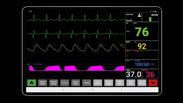 Animated SimVS patient monitor running on a tablet at the bedside, showing live ECG, SpO2, and vital signs