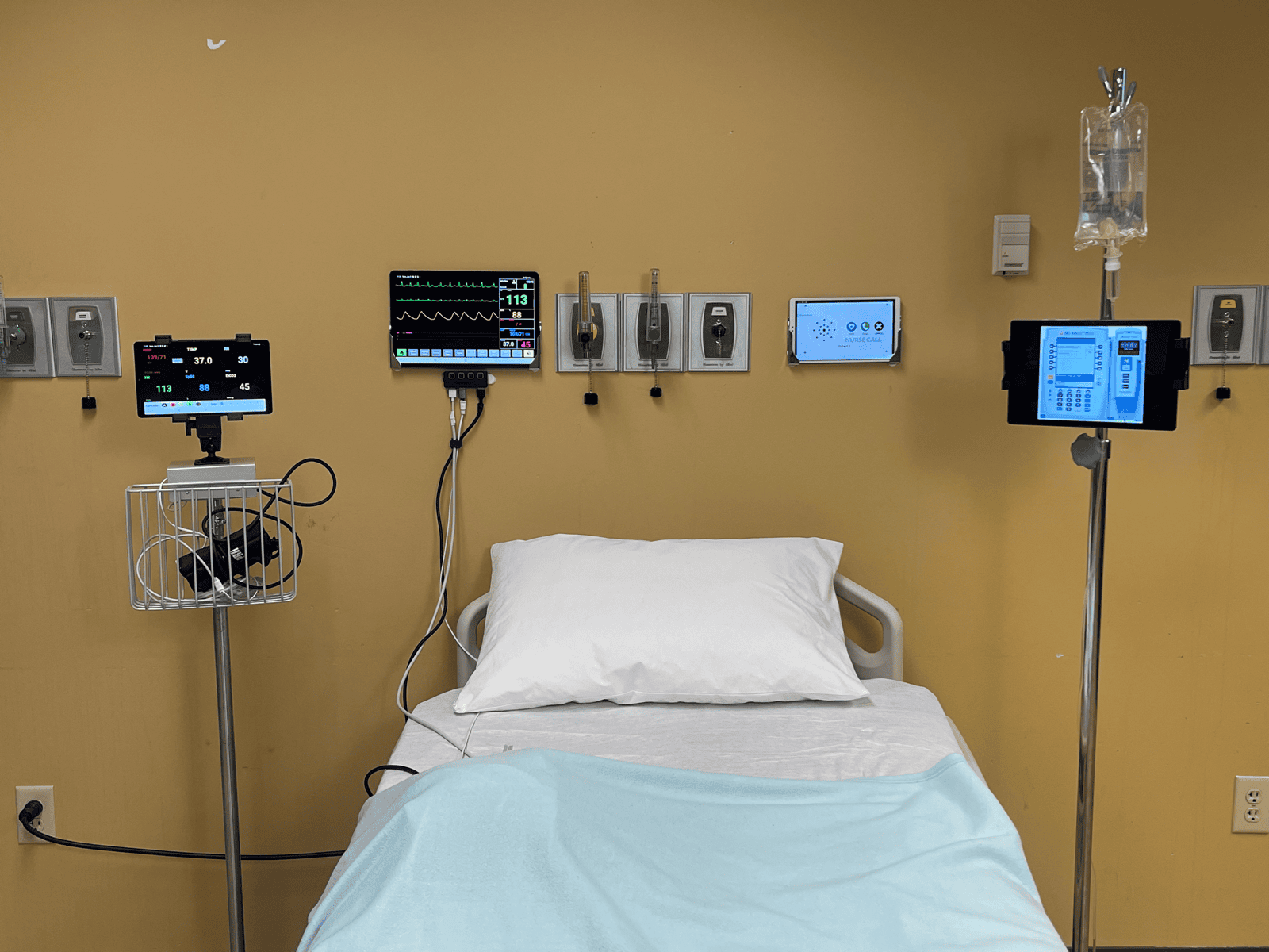 SimVS Nucleus in action